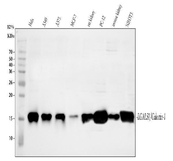 a00470 galectin 1 primary antibodies wb testing 1