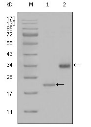 Western Blot (WB) analysis using ApoA Monoclonal antibody against truncated LPA-His recombinant protein (1) and truncated Trx-LPA(aa4330-4521) recombinant protein (2)