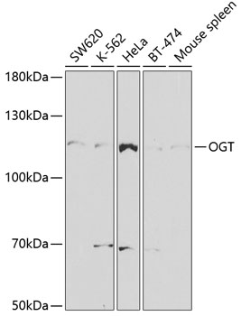 Western blot analysis of extracts of various cell lines, using OGT antibody at 1:1000 dilution