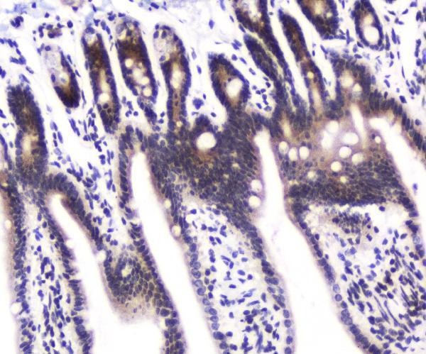 a00475 1 dgcr8 primary antibodies ihc testing 3