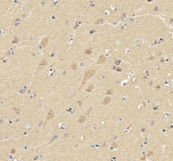 a00476 2 skp1 primary antibodies ihc testing 3