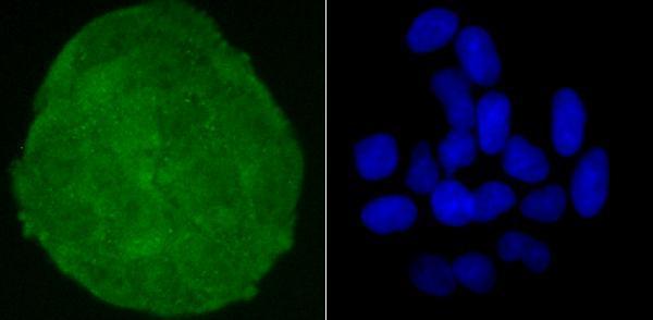 ICC staining Skp1 in Hela cells (green)