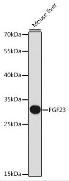Western blot analysis of FGF23 polyclonal antibody