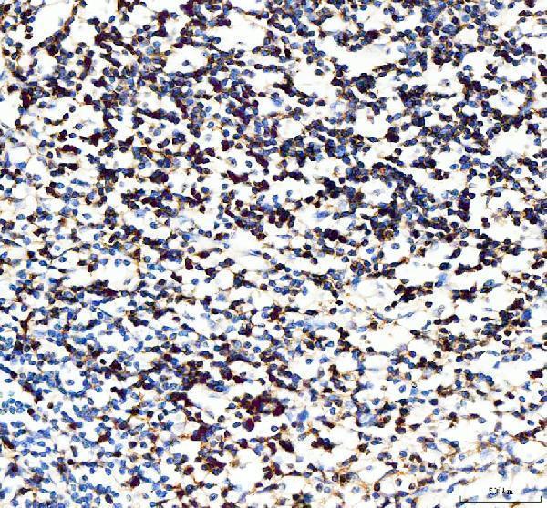 IHC analysis of CD5 using anti-CD5 antibody (A00480-2)