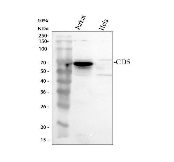 Western blot analysis of CD5 using anti-CD5 antibody (A00480-2)