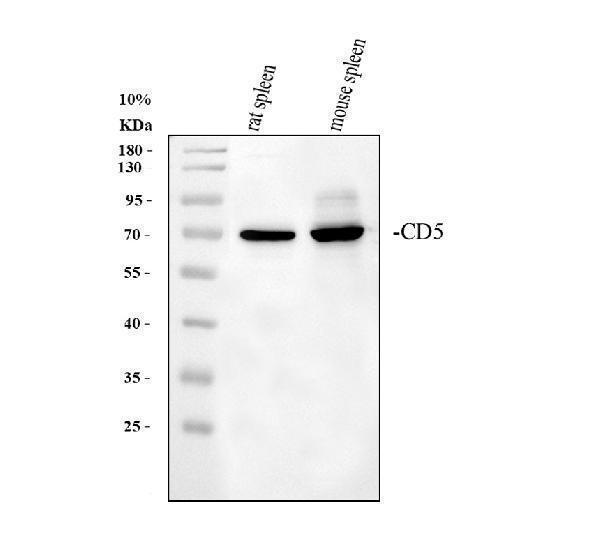 Western blot analysis of CD5 using anti-CD5 antibody (A00480-2)