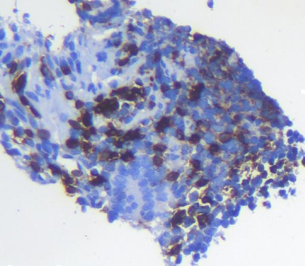  IHC analysis of CD5 using anti-CD5 antibody (A00480-3)