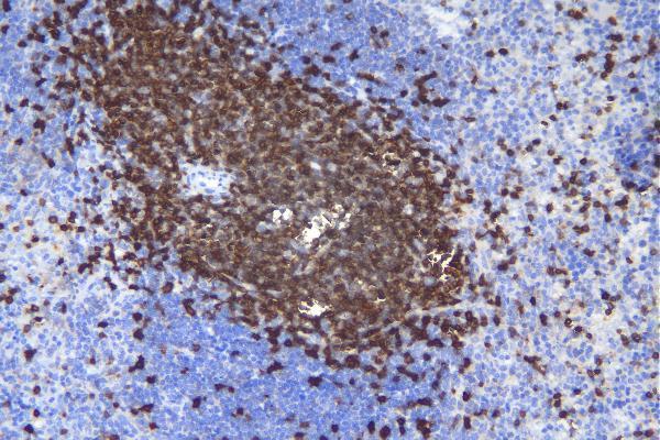  IHC analysis of CD5 using anti-CD5 antibody (A00480-3)