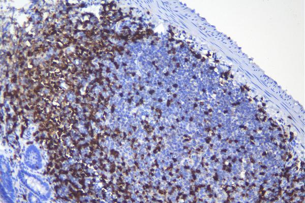 a00480 3 cd5 primary antibodies ihc testing 4