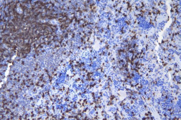 a00480 3 cd5 primary antibodies ihc testing 5