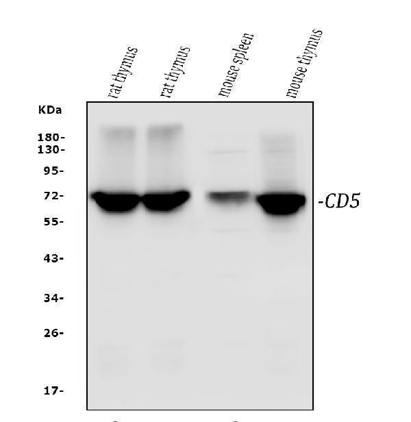  Western blot analysis of CD5 using anti-CD5 antibody (A00480-3)