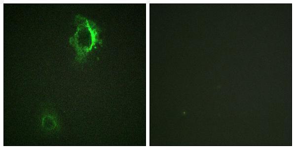 Immunofluorescence analysis of HepG2 cells, using CD5 (Phospho-Tyr453) Antibody