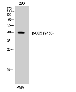 Western Blot analysis of 293 cells using Phospho-CD5 (Y453) Polyclonal Antibody