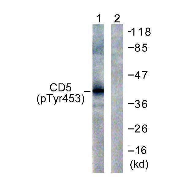 Western blot analysis of lysates from 293 cells treated with PMA 125ng/ml 30