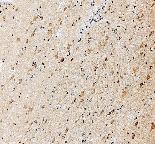 a00481 1 eif3e primary antibodies ihc testing 1