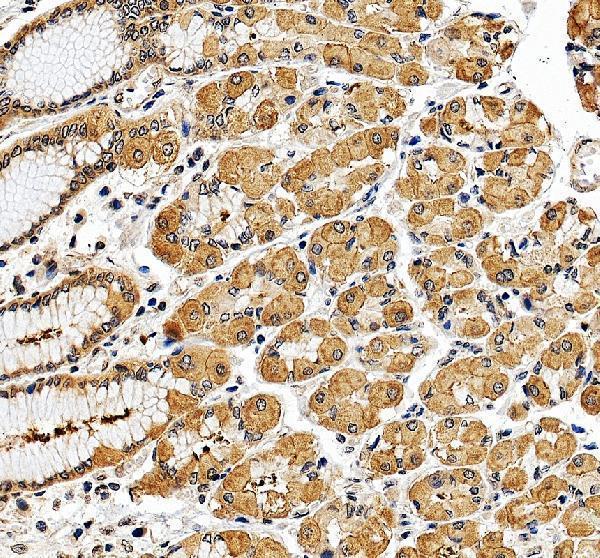 a00481 1 eif3e primary antibodies ihc testing 2
