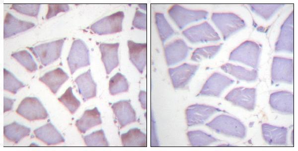 Immunohistochemistry analysis of paraffin-embedded human skeletal muscle, using XIAP (Phospho-Ser87) Antibody