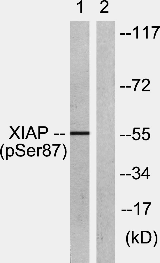 Western blot analysis of lysates from HepG2 cells treated with Anisomycin 25ug/ml 30