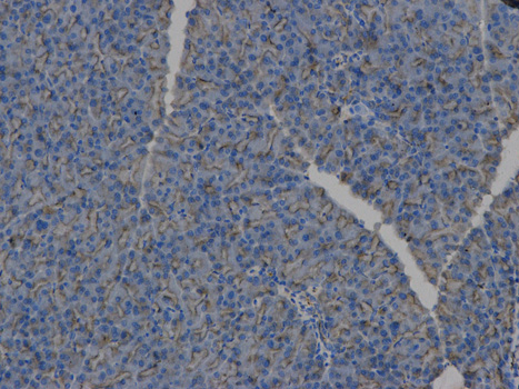 Immunohistochemistry of paraffin-embedded human lymphonodus using HLA-DPB1 antibody  at dilution of 1:100 