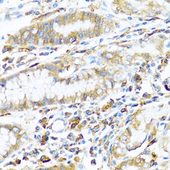 Immunohistochemistry of paraffin-embedded human stomach using HLA-DPB1 antibody  at dilution of 1:100 