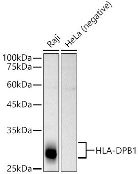 Western blot analysis of extracts of various cell lines, using HLA-DPB1 Rabbit pAb antibody  at 1:1000 dilution