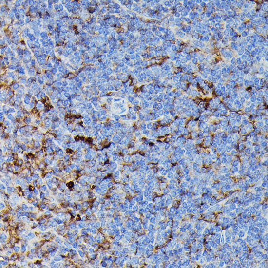 a00487 2 hla dpb1 primary antiboties ihc testing 4