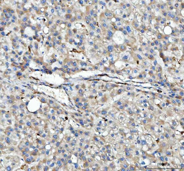  IHC analysis of HLA-DPB1 using anti-HLA-DPB1 antibody (A00487)