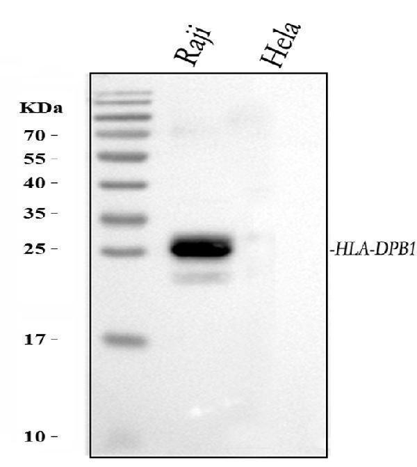  Western blot analysis of HLA-DPB1 using anti-HLA-DPB1 antibody (A00487)