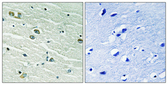 Immunohistochemistry validation of MERTK using Anti-MerTK/Tyro3 Antibody (A00489-1)