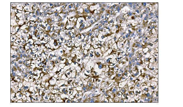 a00489 2 metrk primary antibodies ihc testing 3