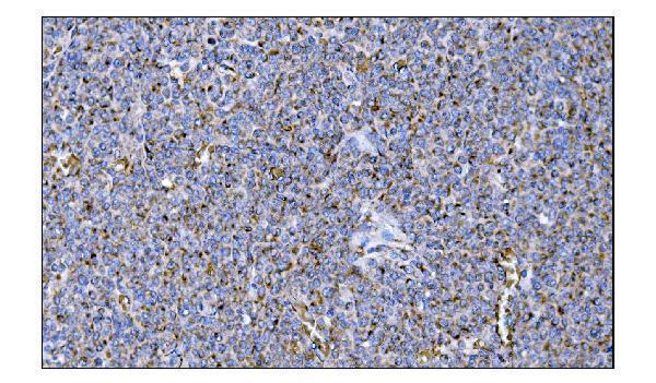 a00489 2 metrk primary antibodies ihc testing 5