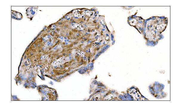 a00489 2 metrk primary antibodies ihc testing 6