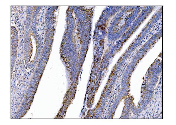 a00489 2 metrk primary antibodies ihc testing 7