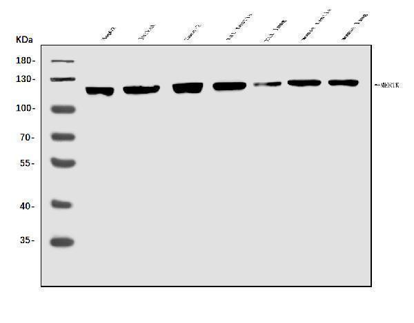 a00489 2 metrk primary antibodies wb testing 1