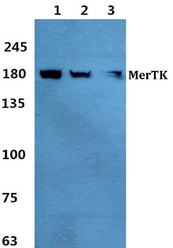 Western blot (WB) analysis of MerTK polyclonal antibody at 1:500 dilution
Lane1:Hela cell lysate
Lane2:Raw264