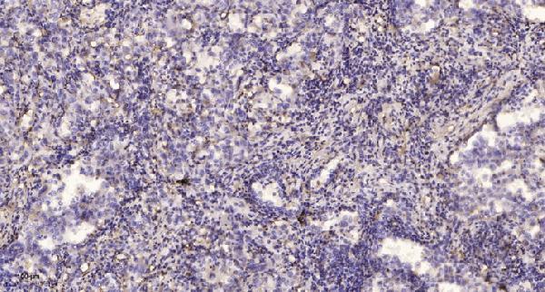 Immunohistochemical analysis of paraffin-embedded human lung cancer