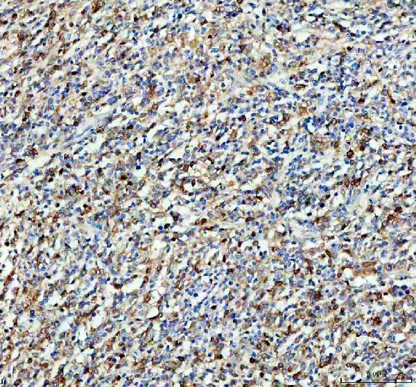 a00490 3 syk primary antibodies ihc testing 1