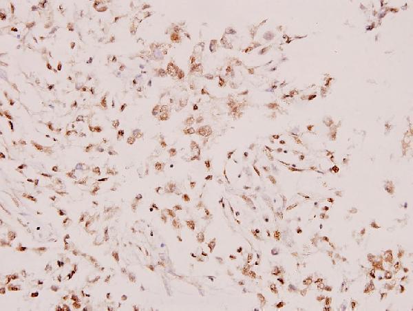 a00490 syk primary antiboties ihc testing 2