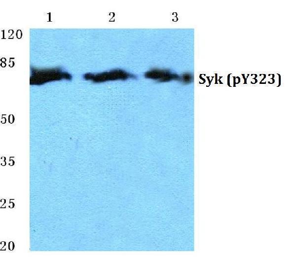 a00490y323 syk primary antiboties wb testing 1