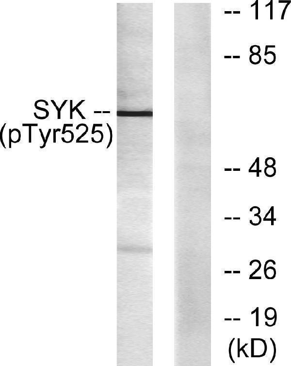 Immunohistochemical analysis of paraffin-embedded Human breast cancer