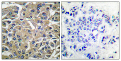 a00490y525 1 syk primary antibodies ihc testing 5