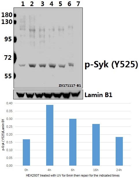 Western blot (WB) analysis of p-Syk (Y525) pAb at 1:500 dilution
Lane1:HEK293T whole cell lysate(40ug)
Lane2:HEK293T treated with UV for 5 minutes then repair for 4 hours whole cell lysate(40ug)
Lane3:HEK293T treated with UV for 5 minutes then repair for 6 hours whole cell lysate(40ug)
Lane4:HEK293T treated with UV for 5 minutes then repair for 16 hours whole cell lysate(40ug)
Lane5:HEK293T treated with UV for 5 minutes then repair for 24 hours whole cell lysate(40ug)
Lane6:The Lung tissue lysate of Rat(40ug)
Lane7:The Uterus tissue lysate of Mouse(40ug)