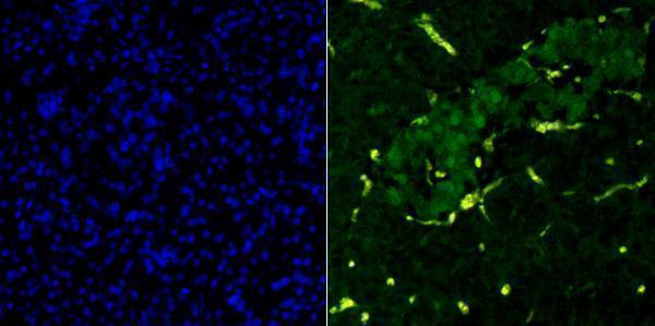 Immunohistochemical analysis of paraffin-embedded human pancreas tissue using anti-PDX1 antibody
