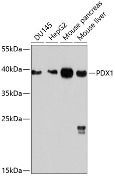 Western blot analysis of extracts of various cell lines, using PDX1 antibody  at 1:1000 dilution