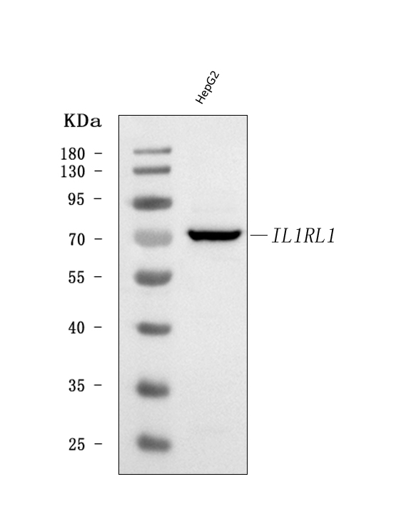  Western blot analysis of ST2/IL1RL1 using anti-ST2/IL1RL1 antibody (A00492-2)
