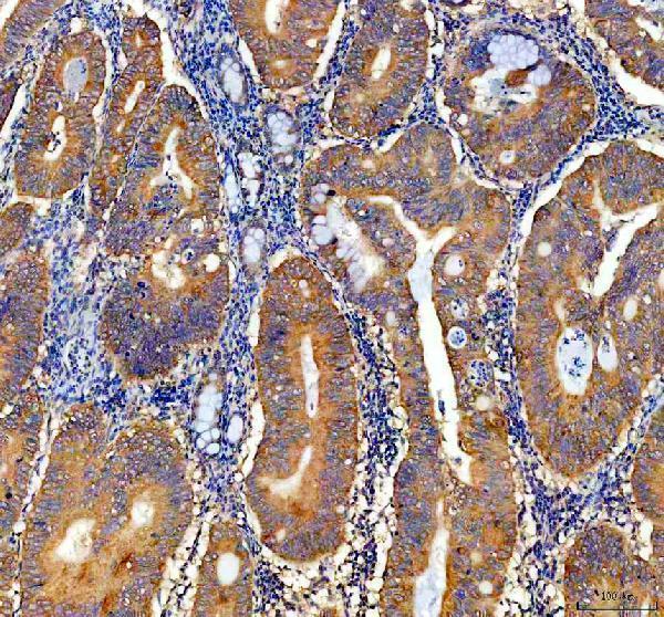 IHC analysis of NQO1 using anti-NQO1 antibody (A00494-2)