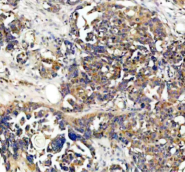 IHC analysis of NQO1 using anti-NQO1 antibody (A00494-2)