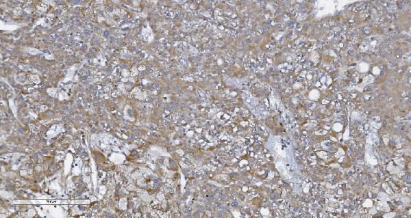 a00495 2 nod1 primary antibodies ihc testing 3