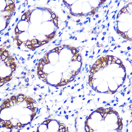 Immunohistochemistry of paraffin-embedded human colon using Serotonin transporter Rabbit pAb  at dilution of 1:100 