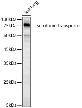 Western blot analysis of Rat lung, using Serotonintransporter antibody  at  1:500 dilution